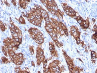 HER-2 / CD340 Monoclonal Mouse Antibody (ErbB2/3093)