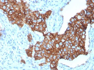 HER-2 / CD340 Monoclonal Mouse Antibody (ErbB2/3257)