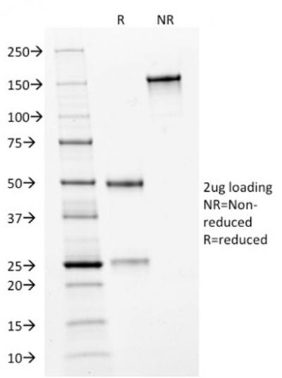 HER-2 / CD340 Monoclonal Mouse Antibody (HRB2/282)