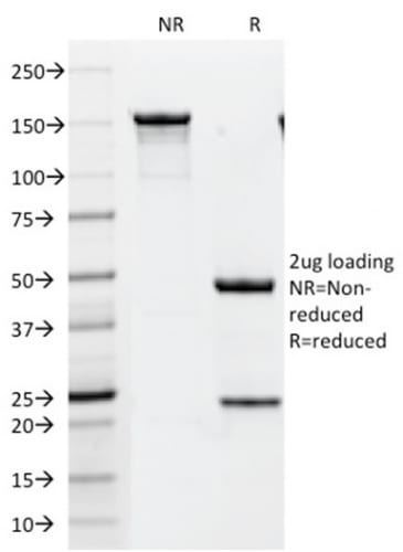 HER-2 / CD340 Monoclonal Mouse Antibody (HRB2/451)