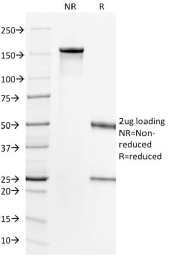 HER-2 / CD340 Monoclonal Mouse Antibody (HRB2/718)
