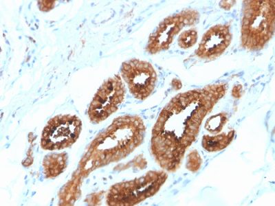 HER-4 / ERBB4 Monoclonal Mouse Antibody (ERBB4/2581)
