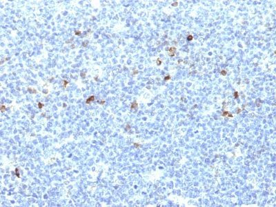 HLA-Aw32-&-HLA-A25 Monoclonal Mouse Antibody (CATA-1)	