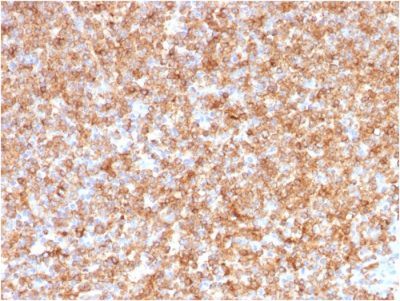 HLA-DP/-DQ/-DR Monoclonal Mouse Antibody (CR3/43)