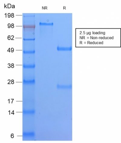 HLA-DQ Recombinant Monoclonal Rabbit Antibody (HLA-DQA1/2866R)