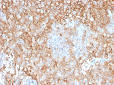 HLA-DR Monoclonal Mouse Antibody (TAL 1B5)
