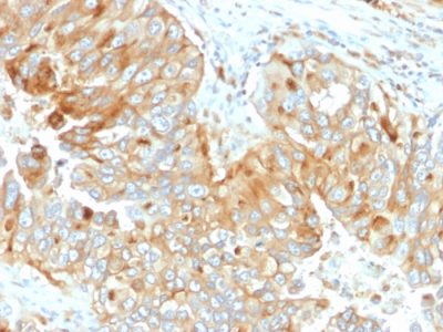 HLA-DRB Monoclonal Mouse Antibody (DA2)