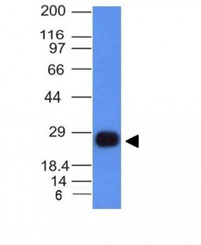 HLA-DRB Monoclonal Mouse Antibody (HLA-DRB/1067)
