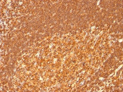 HLA-DRB Monoclonal Mouse Antibody (HLA-DRB/1067)