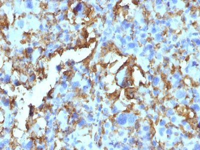 HLA-DRB Monoclonal Mouse Antibody (LN-3 + HLA-DRB/1067)