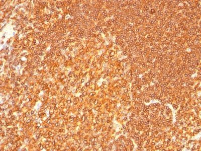 HLA-DRB Monoclonal Mouse Antibody (LN-3 + HLA-DRB/1067)