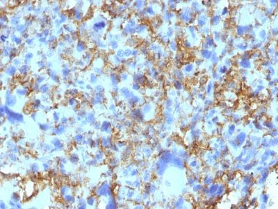 HLA-DRB Monoclonal Mouse Antibody (LN-3)