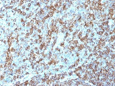 HLA-DRB Monoclonal Mouse Antibody (LN-3)