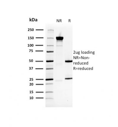 HSP27 Monoclonal Mouse Antibody (CPTC-HSPB1-2)
