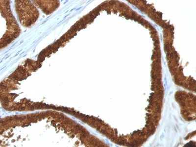 IDH1 Monoclonal Mouse Antibody (IDH1/1152)
