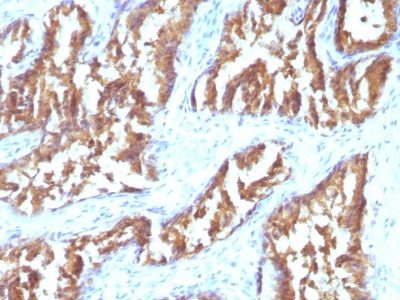 IDH1 Monoclonal Mouse Antibody (IDH1/1152)