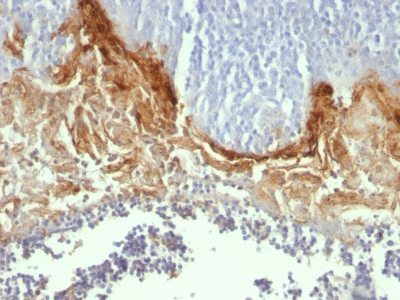 Involucrin Monoclonal Mouse Antibody (SY5)