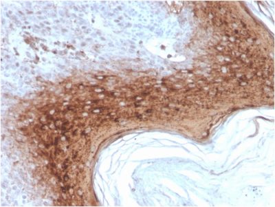 Involucrin Recombinant Monoclonal Mouse Antibody (rIVRN/827)