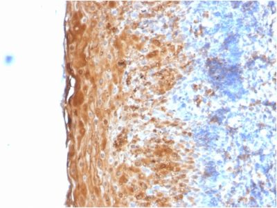 Involucrin Recombinant Monoclonal Rabbit Antibody (IVRN/2113R)