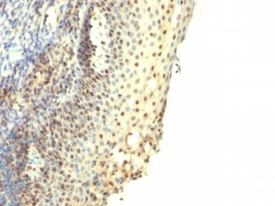 IPO-38 Monoclonal Mouse Antibody (IPO-38)
