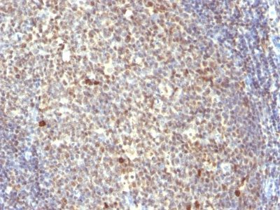 IPO-38 Monoclonal Mouse Antibody (IPO-38)