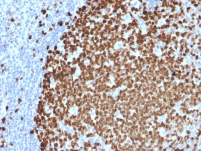 Ki-67 Monoclonal Mouse Antibody (MKI67/2461)