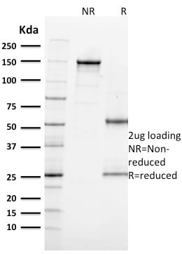 Ki-67 Monoclonal Mouse Antibody (MKI67/2462)