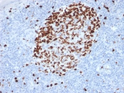 Ki-67 Monoclonal Mouse Antibody (MKI67/2462)