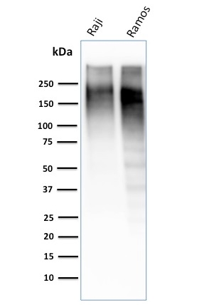 Ki-67 Monoclonal Mouse Antibody (MKI67/2462)