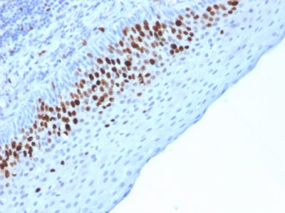 Ki-67 Monoclonal Mouse Antibody (MKI67/2463)