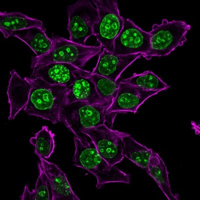 Ki-67 Monoclonal Mouse Antibody (MKI67/2465)