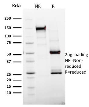 Ki-67 Monoclonal Mouse Antibody (MKI67/2465)