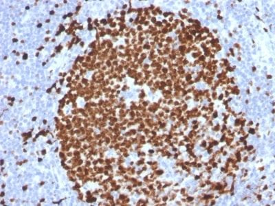 Ki-67 Monoclonal Mouse Antibody (MKI67/2465)