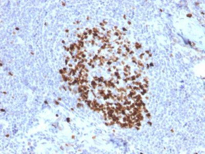 Ki-67 Monoclonal Mouse Antibody (MKI67/2466)