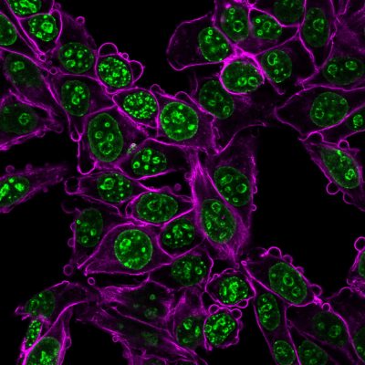 Ki-67 Monoclonal Mouse Antibody (MKI67/2466)