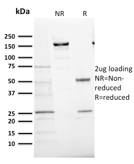 Ki-67 Monoclonal Mouse Antibody (MKI67/2466)