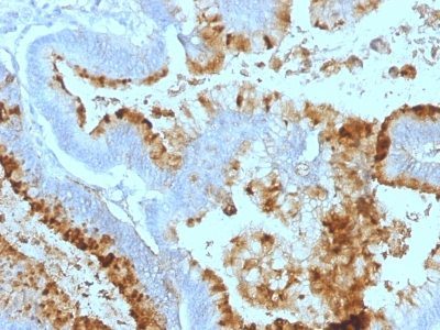 Lewis-A Monoclonal Mouse Antibody (7LE)