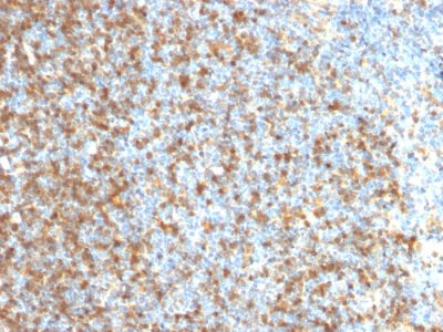 LMO2 Monoclonal Mouse Antibody (LMO2/1971)