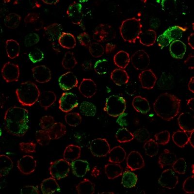 LMO2 Recombinant Monoclonal Rabbit Antibody (LMO2/3147R)