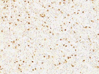Luteinizing Hormone-Beta Monoclonal Mouse Antibody (LHb/1214)