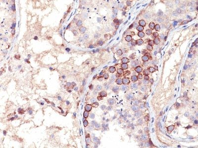 MAGE-A1 Monoclonal Mouse Antibody (MA454)