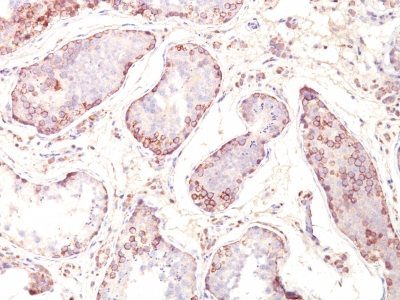 MAGE-A1 Monoclonal Mouse Antibody (MZ2E/838)