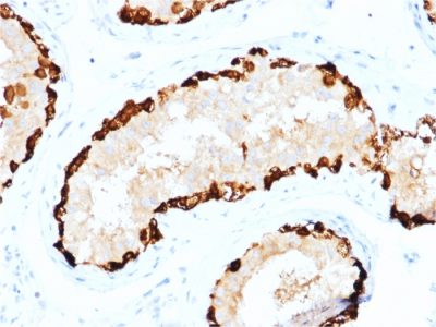 MAGE-A4 Monoclonal Mouse Antibody (CPTC-MAGEA4-1)