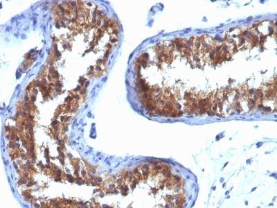 Major Vault Protein Monoclonal Mouse Antibody (1032)