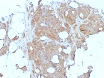 Major Vault Protein Monoclonal Mouse Antibody (1032)