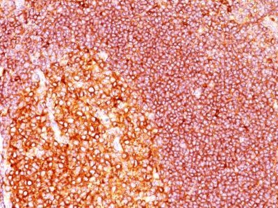 MALT-1 Monoclonal Mouse Antibody (MT1/410)