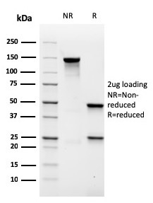 MALT1 Recombinant Monoclonal Mouse Antibody (rMT1/410)