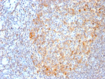 MALT1 Recombinant Monoclonal Rabbit Antibody (MT1/3159R)