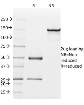 Mammaglobin Monoclonal Mouse Antibody (MGB1/2000)