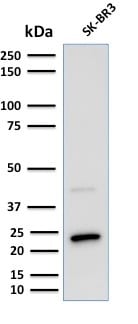 Mammaglobin Monoclonal Mouse Antibody (MGB1/2000)